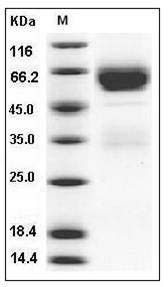 Mouse SerpinA11 Protein (His Tag) SDS-PAGE