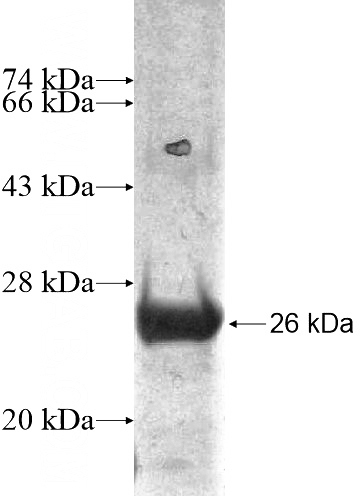 Recombinant Human C15orf41 SDS-PAGE