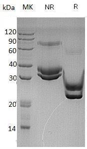 Human CFHR2/CFHL2/FHR2/HFL3 (His tag) recombinant protein