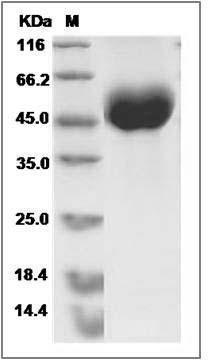Mouse OBCAM / OPCML Protein (His Tag) SDS-PAGE