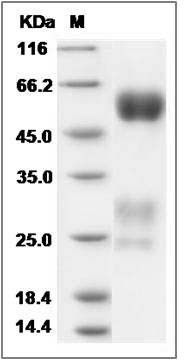 Rat GGT1 Protein (His Tag) SDS-PAGE