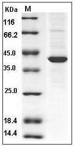 Human ABHD4 Protein (His Tag) SDS-PAGE