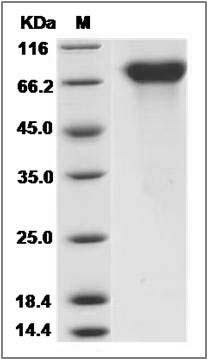 Human PROS1 / Protein S Protein (His Tag) SDS-PAGE