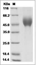 Ebola virus EBOV (subtype Zaire, strain H.sapiens-wt/GIN/2014/Kissidougou-C15) Glycoprotein / GP-RBD Protein (His Tag)