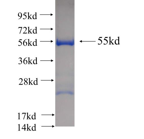 Recombinant human MITD1 SDS-PAGE