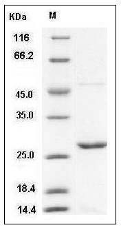 Mouse Peroxiredoxin 1 / PRDX1 Protein (His Tag) SDS-PAGE