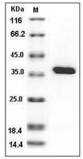 Human PTP1B / PTPN1 Protein (His Tag)