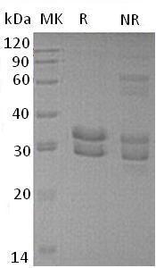 Human ITM2B/BRI/BRI2 (His tag) recombinant protein