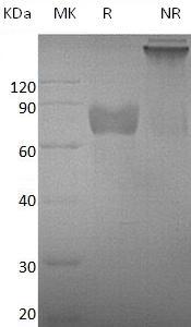 Mouse Ghr/mCG_141048 (Fc tag) recombinant protein