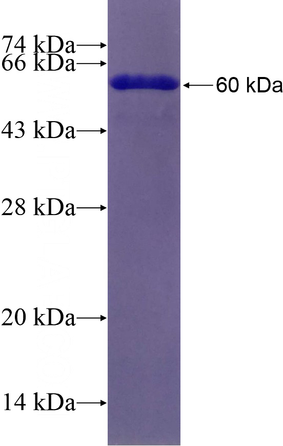Recombinant Human TM9SF4 SDS-PAGE
