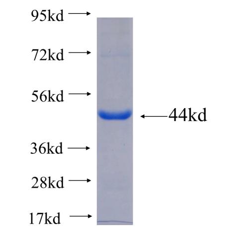 Recombinant human TKT SDS-PAGE