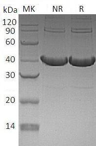 Human MCL1/BCL2L3 (His tag) recombinant protein