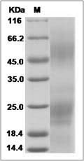Ebola virus EBOV (subtype Zaire, strain H.sapiens-wt/SLE/2014/ManoRiver-G3686.1) EBOV-G / Glycoprotein Protein (His Tag)