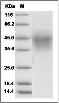 Human TMEM25 Protein (His Tag) SDS-PAGE