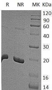 Human TNF/TNFA/TNFSF2 (His tag) recombinant protein