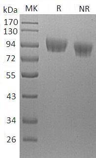 Human PECAM1 (His tag) recombinant protein