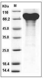Mouse Granulin / GRN / Progranulin Protein (His Tag) SDS-PAGE
