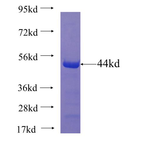 Recombinant human ADAT3 SDS-PAGE