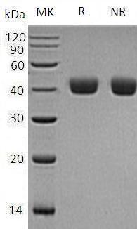 Human ALDOC/ALDC (His tag) recombinant protein