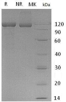 Human CDH17 (His tag) recombinant protein