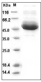 Human Cathepsin A / CTSA Protein (His Tag) SDS-PAGE