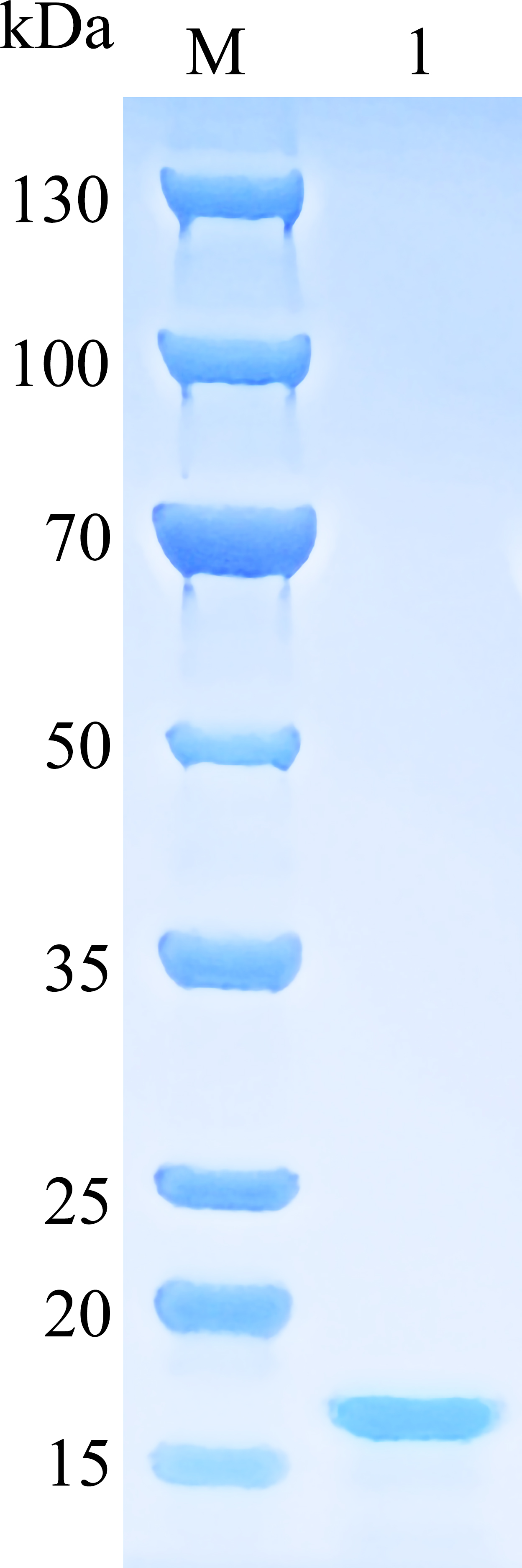 Human MMP12 / MMP-12 / HME Protein (catalytic domain) SDS-PAGE