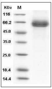 Human DLL4 / Delta4 Protein (His Tag) SDS-PAGE