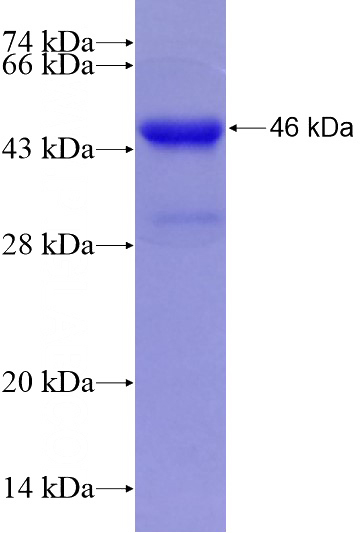 Recombinant Human NR3C2 SDS-PAGE