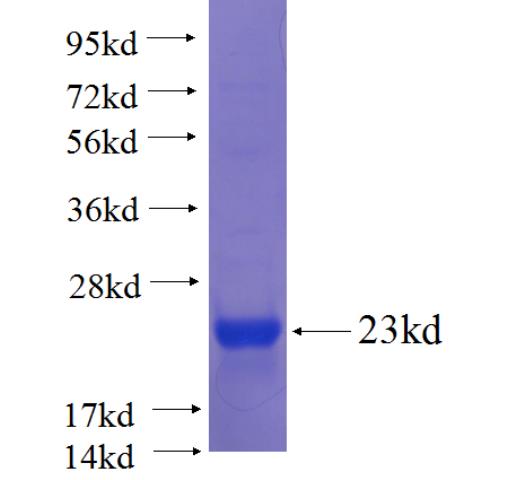 Recombinant human GALNT9 SDS-PAGE