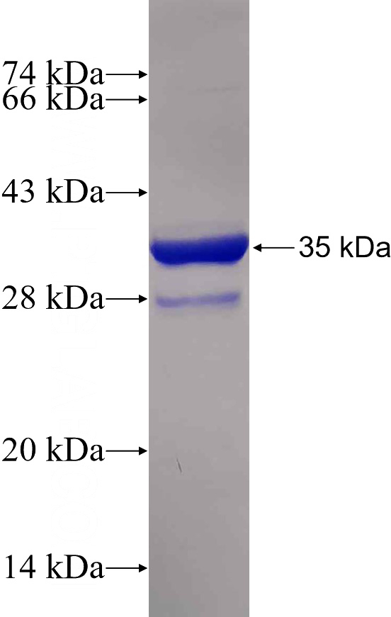 Recombinant Human SMPX SDS-PAGE