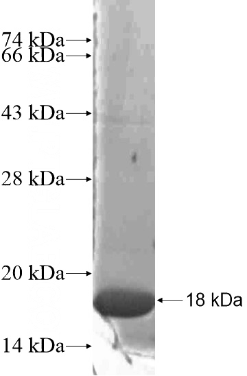 Recombinant Human HEATR2 SDS-PAGE