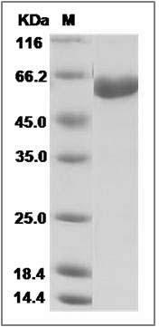 Influenza A H7N9 (A/Hangzhou/3/2013) Hemagglutinin / HA Protein (His Tag) SDS-PAGE