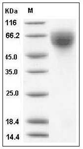 Influenza A H1N1 (A/Brisbane/59/2007) Hemagglutinin Protein (HA1 Subunit) (His Tag) SDS-PAGE