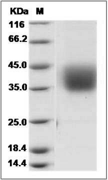 Cynomolgus Epcr / PROCR Protein (His Tag) SDS-PAGE