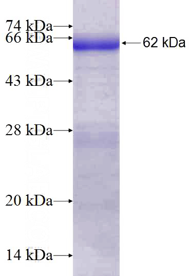 Recombinant Human HPSE SDS-PAGE