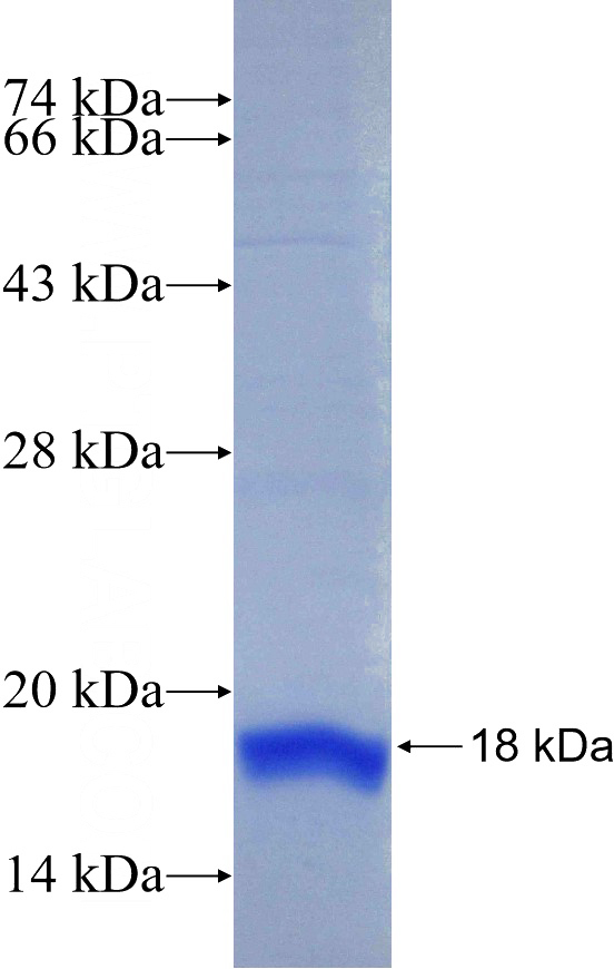 Recombinant Human RSPO4 SDS-PAGE