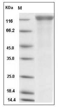 Rat VEGFR2 / Flk-1 / CD309 / KDR Protein (His Tag) SDS-PAGE