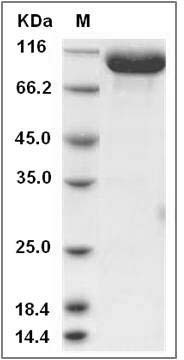 Rat EphA4 Protein (Fc Tag) SDS-PAGE