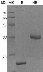 Human CRNN/C1orf10/DRC1/PDRC1/SEP53 (His tag) recombinant protein