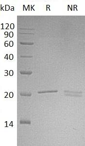 Human NIP7/CGI-37/HSPC031/HSPC180 (His tag) recombinant protein