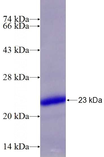 Recombinant Human TNFAIP8L1 SDS-PAGE