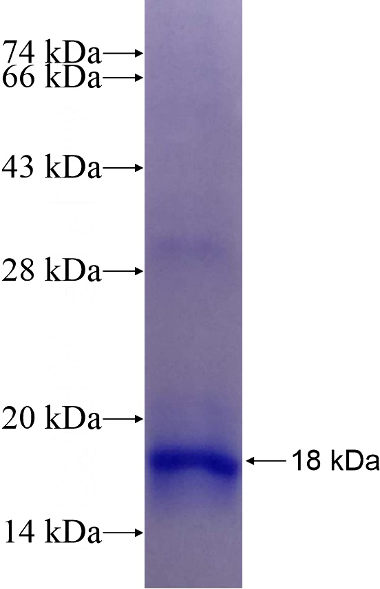Recombinant Human SPP SDS-PAGE