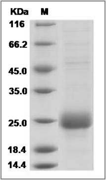 Human CTLA4 / CD152 Protein (His Tag) SDS-PAGE