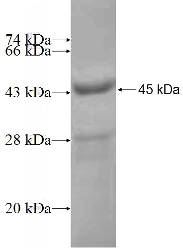 Recombinant Human SLC27A2 SDS-PAGE
