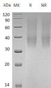 Mouse Slamf9 (His tag) recombinant protein