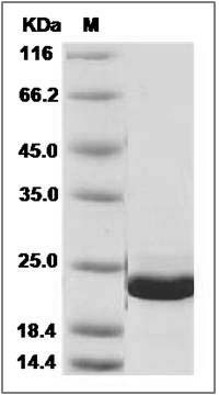 Human ARF5 / ADP-ribosylation factor 5 Protein (His Tag) SDS-PAGE