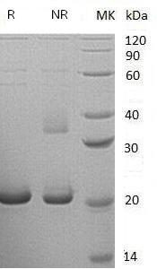 Human CYB5B/CYB5M/OMB5 (His tag) recombinant protein