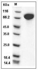 Mouse c-kit / CD117 Protein (His Tag) SDS-PAGE
