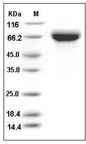 Influenza A H5N1 (A/whooper swan/Mongolia/244/2005) Hemagglutinin / HA Protein (His Tag) SDS-PAGE