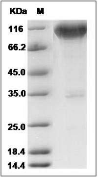 Rat TrkA / NTRK1 Protein (Fc Tag) SDS-PAGE